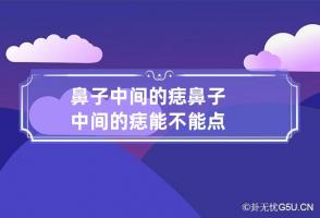 鼻子中间的痣 鼻子中间的痣能不能点